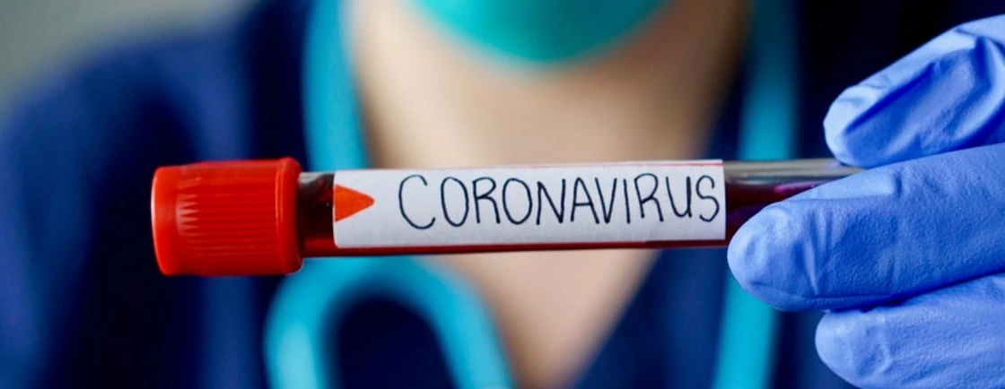 médico segurando frasco de sangue escrito coronavirus